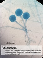 Image result for "cubotholus Spp.". Size: 139 x 185. Source: www.grepmed.com