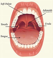Image result for Normal Tonsils and Adenoids. Size: 172 x 185. Source: www.dxline.info