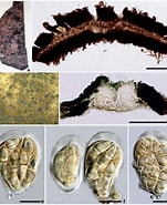 Image result for "nematoscelis Tenella". Size: 151 x 185. Source: www.facesoffungi.org