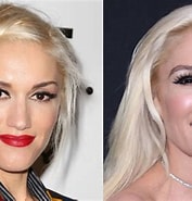 Bildresultat för What Happened To Gwen Stefani's Face. Storlek: 177 x 185. Källa: www.lifeandstylemag.com