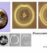 Image result for "prorocentrum Concavum". Size: 165 x 115. Source: www.whoi.edu