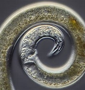 Image result for "procerastea Nematodes". Size: 176 x 185. Source: www.thoughtco.com