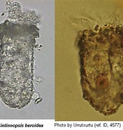 Afbeeldingsresultaten voor "tintinnopsis Baltica". Grootte: 176 x 185. Bron: web.nies.go.jp