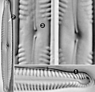 Afbeeldingsresultaten voor Hesionura elongata Stam. Grootte: 191 x 185. Bron: diatoms.org
