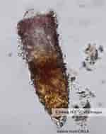 Image result for "Tintinnopsis beroidea". Size: 150 x 189. Source: images.cnrs.fr