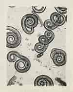 Bildergebnis für "rhabdonella Spiralis". Größe: 150 x 189. Quelle: fity.club
