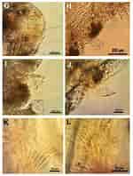 Image result for Magelona filiformis Stam. Size: 150 x 198. Source: www.researchgate.net