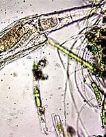 Afbeeldingsresultaten voor Eumetazoa. Grootte: 155 x 200. Bron: www.pinterest.com
