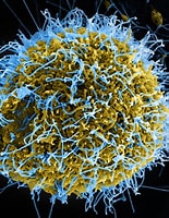 Résultat d’image pour Virus. Taille: 155 x 200. Source: directorsblog.nih.gov