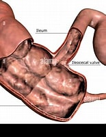 Afbeeldingsresultaten voor Ileocecal valve. Grootte: 155 x 200. Bron: www.alamy.com