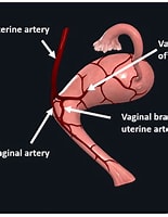 Image result for vaginal artery. Size: 155 x 200. Source: geekymedics.com