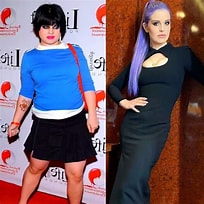 Image result for Kelly Osbourne Surgery. Size: 204 x 204. Source: mexicobariatriccenter.com