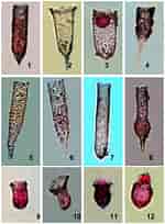 Image result for "tintinnopsis Parvula". Size: 150 x 204. Source: www.researchgate.net