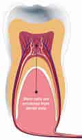 3rd molar dental pulp Cells માટે ઇમેજ પરિણામ. માપ: 120 x 204. સ્ત્રોત: renaissance.com.cy