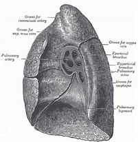 Image result for posttraumatische Pneumatocele Im Ligamentum Pulmonale Inferior. Size: 201 x 206. Source: images.radiopaedia.org