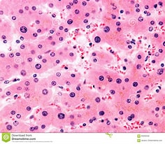Image result for nuclei in Polyploid Plant Cell. Size: 236 x 206. Source: www.dreamstime.com