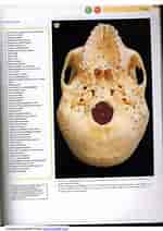 Image result for Arcida Anatomie. Size: 150 x 212. Source: es.slideshare.net