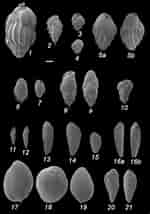 Image result for Granuloreticulosa. Size: 150 x 214. Source: link.springer.com