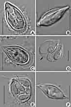 Afbeeldingsresultaten voor "pterocyrtidium Dogieli". Grootte: 146 x 220. Bron: www.researchgate.net