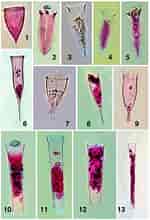 Image result for "rhabdonella Spiralis". Size: 150 x 220. Source: www.researchgate.net