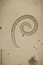 Afbeeldingsresultaten voor "acanthospira'spiralis". Grootte: 150 x 226. Bron: stock.adobe.com