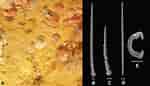 Afbeeldingsresultaten voor "hymedesmia Pilata". Grootte: 150 x 86. Bron: www.researchgate.net