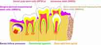 3rd molar dental pulp Cells માટે ઇમેજ પરિણામ. માપ: 208 x 92. સ્ત્રોત: christennorfleet.blogspot.com