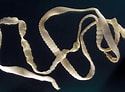 Image result for Corycaeidae Worm. Size: 125 x 92. Source: www.nhs.uk