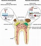 3rd Molar dental pulp Cells के लिए छवि परिणाम. आकार: 82 x 92. स्रोत: www.semanticscholar.org