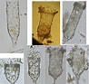 Afbeeldingsresultaten voor "Tintinnopsis Parvula". Grootte: 98 x 93. Bron: web.nies.go.jp