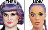 Image result for Kelly Osbourne Surgery. Size: 155 x 97. Source: www.youtube.com