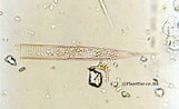 Image result for "Helicostomella subulata". Size: 161 x 98. Source: biodic07.blog97.fc2.com