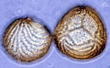 Image result for "thecosphaera Inermis". Size: 159 x 98. Source: www.nsf.gov