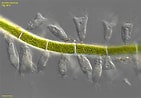 Afbeeldingsresultaten voor "acineta Tuberosa". Grootte: 141 x 98. Bron: realmicrolife.com