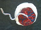 Image result for "cardiapoda Placenta". Size: 131 x 98. Source: www.pinterest.co.uk