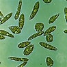 Afbeeldingsresultaten voor "leptognathia Gracilis". Grootte: 98 x 98. Bron: eukaryoticmicrobe.blogspot.com