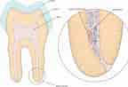 Image result for Dental Pulp cells. Size: 144 x 98. Source: www.thelancet.com