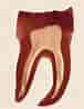 3rd Molar Dental Pulp Cells-க்கான படிம முடிவு. அளவு: 76 x 98. மூலம்: pocketdentistry.com