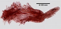 Tamaño de Resultado de imágenes de Scoletoma Magnidentata Stam.: 205 x 98. Fuente: www.marinespecies.org
