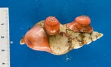 Image result for "hormathia Digitata". Size: 163 x 98. Source: www.marinespecies.org