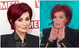Image result for Sharon Osbourne Before Surgery. Size: 161 x 99. Source: www.closerweekly.com