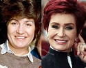 Image result for Sharon Osbourne Before Surgery. Size: 125 x 99. Source: www.plasticsurgerypeople.com