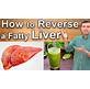 How To Heal Fatty Liver Naturally
