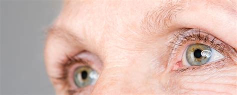 glaucoma ohio state eye care ophthalmology