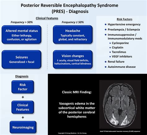 posterior reversible encephalopathy syndrome  year  sexiezpicz web porn