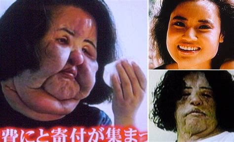 10 craziest plastic surgeries you have to see to believe
