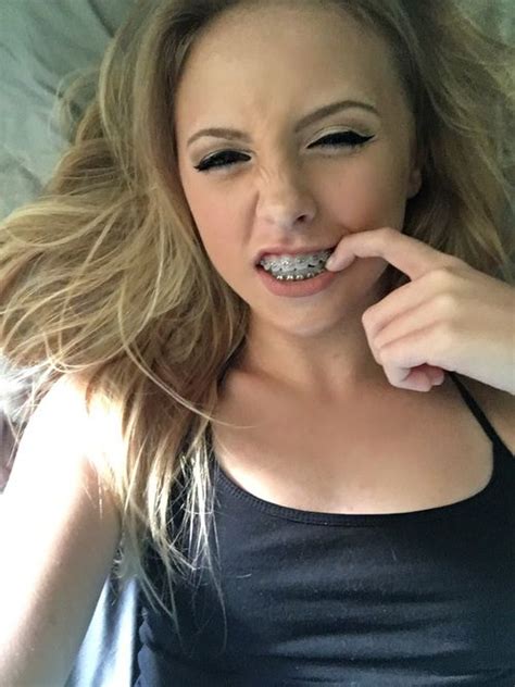 selfies exclusivas para chicas con brackets frenillos dentales