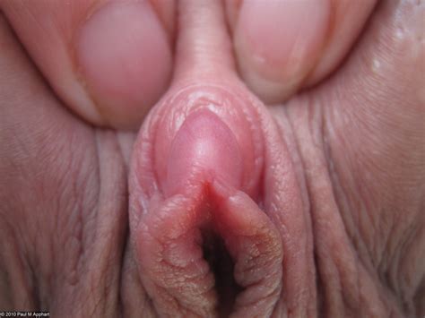 clitoris closeup sex nurse local