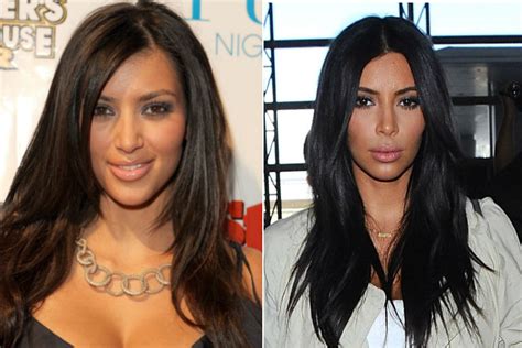 Celebrity Plastic Surgery Before And After Photos