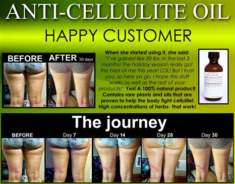 All Natural Anti Cellulite Oil Treatment That Works For